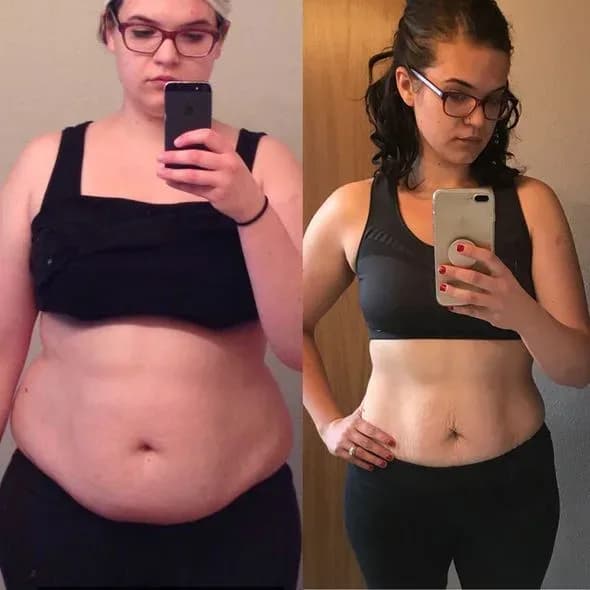 Audra, 22, before and after