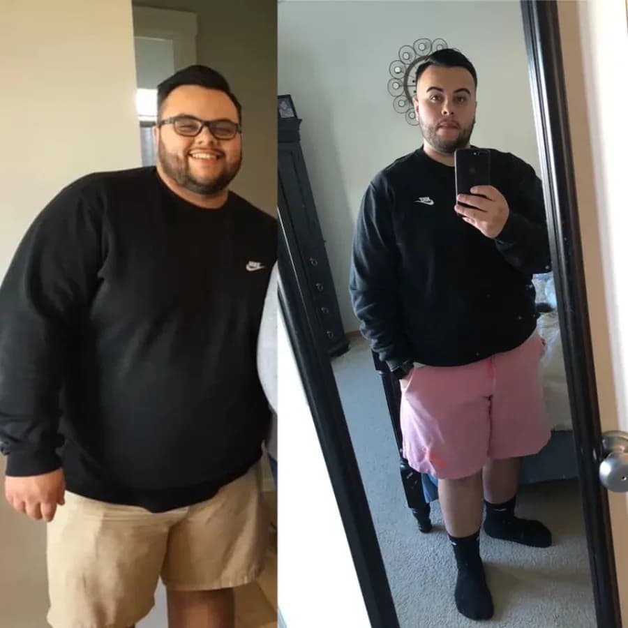 Daniel, 25, before and after
