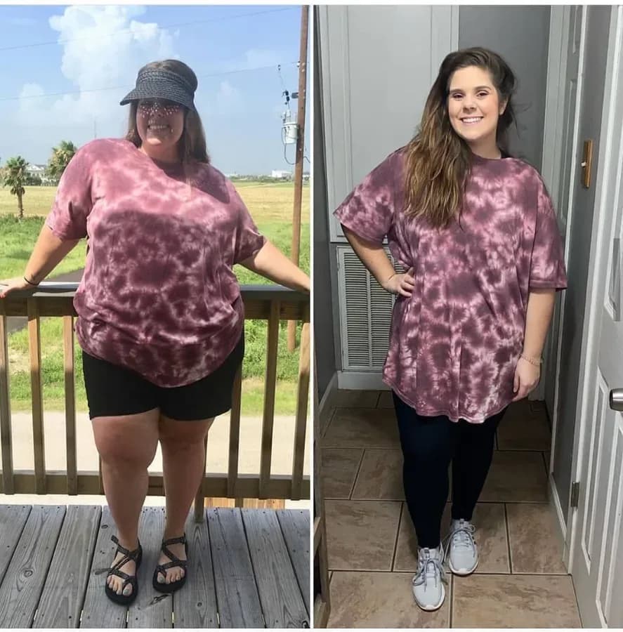 Emily, 32, before and after