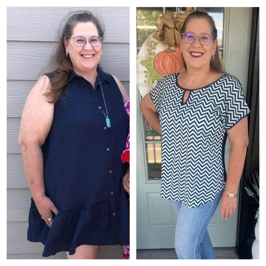 Lauren, 46, before and after