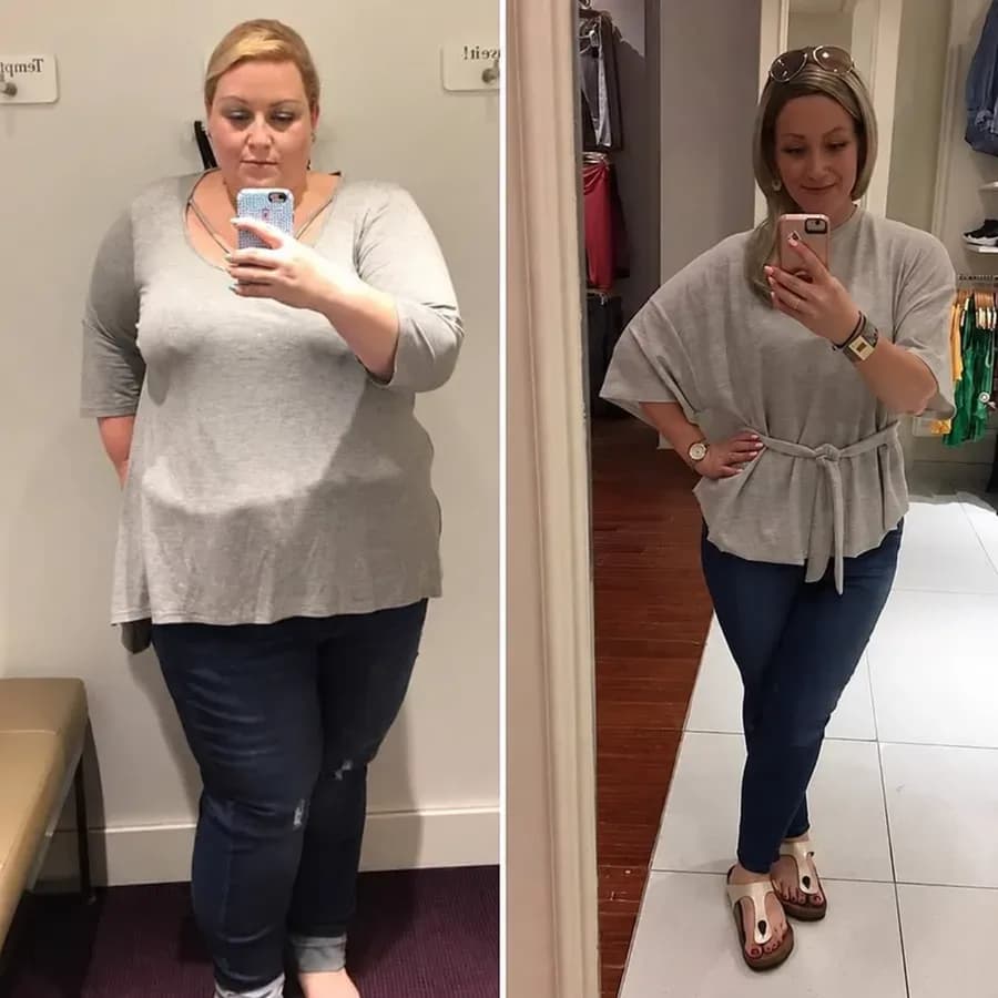 Megan, 35, before and after